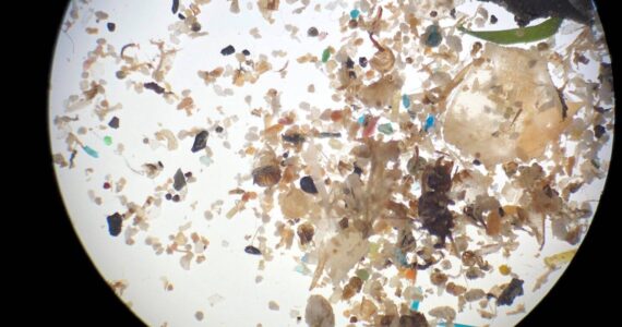 Photo credit to Hudson River Park
Micro-photograph of microplastics collected from Hudson River water.